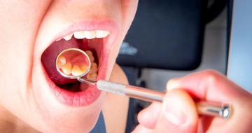 Damak Şişmesi Belirtileri ve Tedavisi