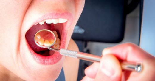 Damakta Şişlik Belirtileri ve Tedavisi