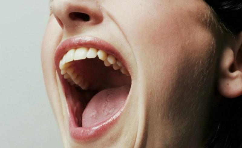 Damak Yarası Belirtileri ve Tedavisi